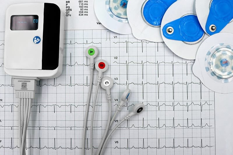 Integração do ASO com PCMSO: aparelho medico e exames vistos por cima na mesa