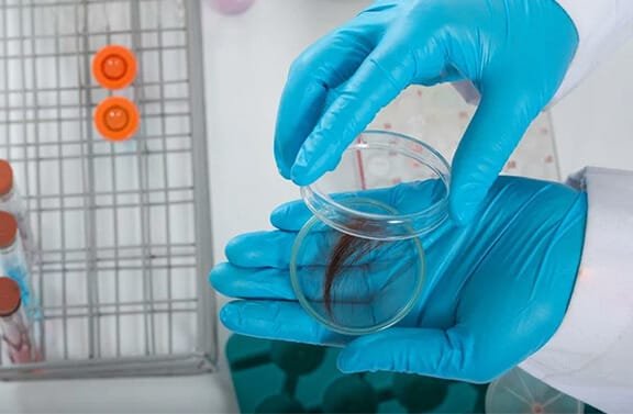 Exame toxicológico em Brasília oferecido pela Nova Medicina e Segurança do Trabalho. Soluções seguras para conformidade trabalhista.